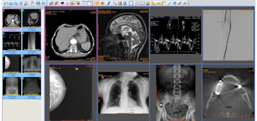 Sante DICOM Editor v10.3.1