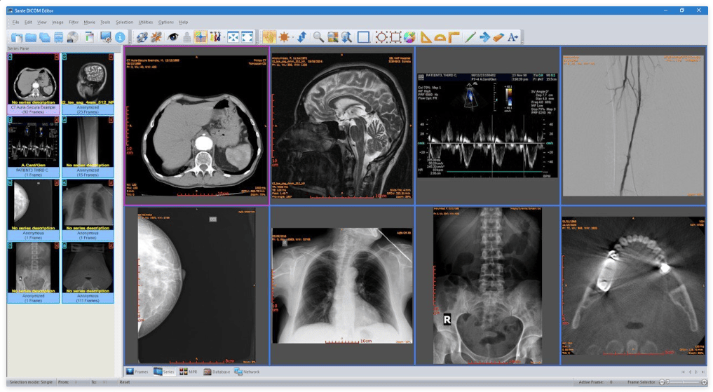 Sante DICOM Editor v10.3.1