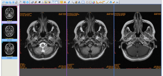 Sante DICOM Viewer Pro v14.3