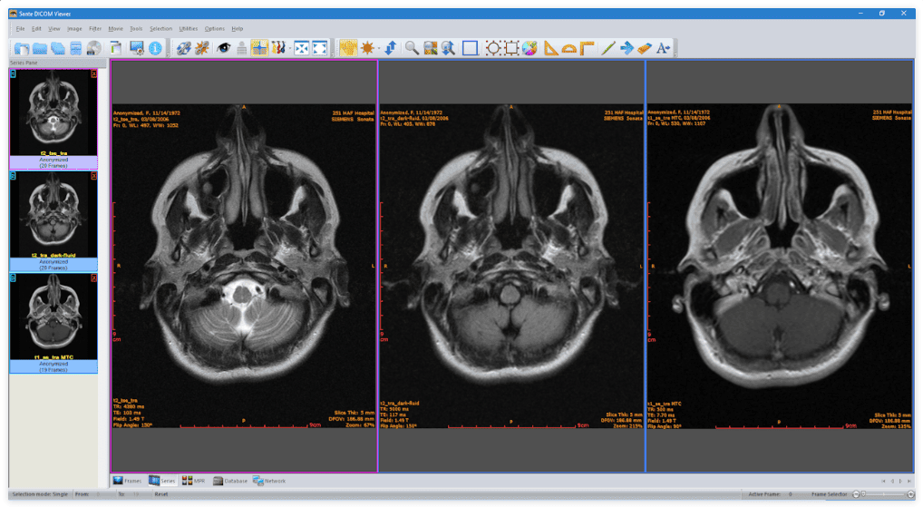 Sante DICOM Viewer Pro v14.3