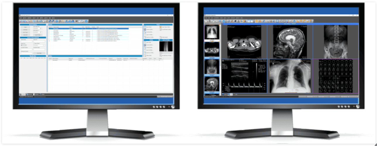 Sante PACS Server PG v4.4.1