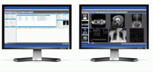 Sante PACS Server PG 4.4.4